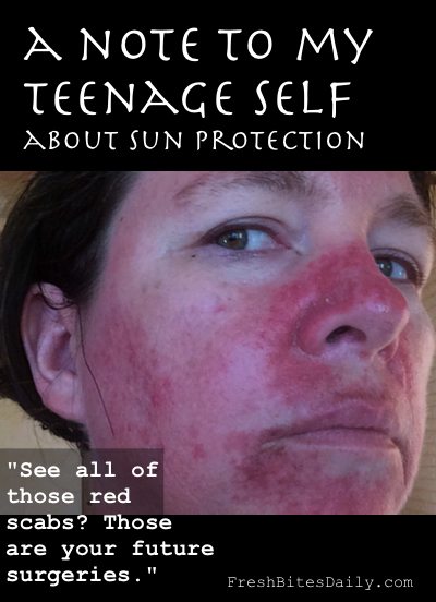 A graphic picture as evidence that prevention is easier than treatment when it comes to skin cancer (and a simple remedy you can try today)